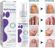 FUNGAL NAIL TREATMENT FOR TOENAILS EXTRA STRONG,100ML SPRAY FOR NAILS